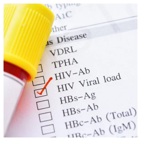 Carga viral para VIH-1