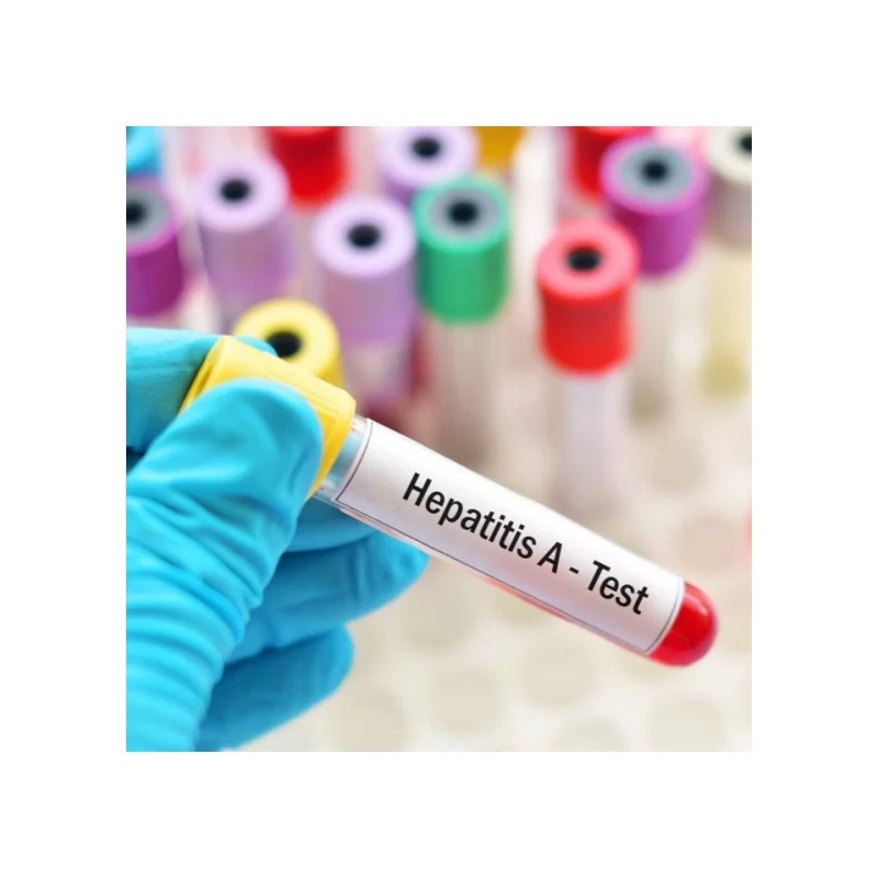 Anticuerpos Totales Hepatitis A