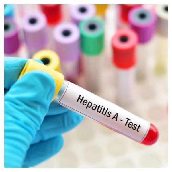 Anticuerpos Totales Hepatitis A