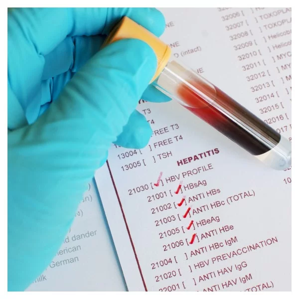 Anticuerpos contra Antígeno de superficie de Hepatitis B