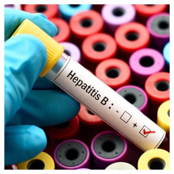 Anticuerpos totales contra Antígeno core de Hepatitis B