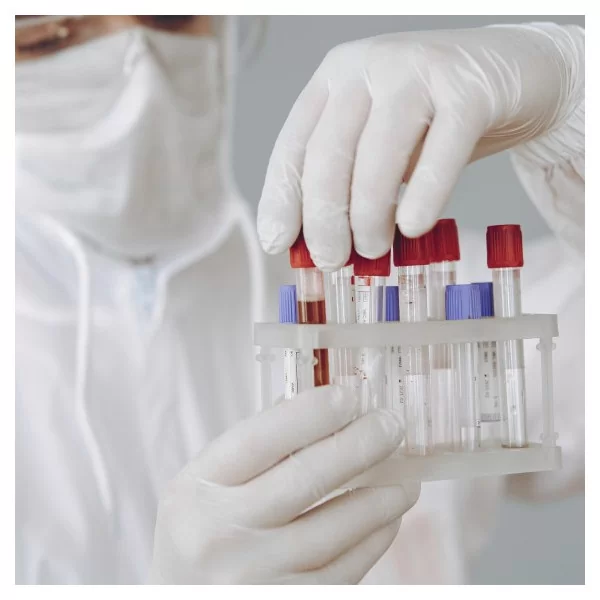 Antígeno de superficie de Hepatitis B