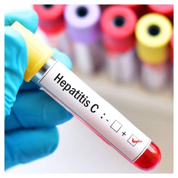Anticuerpos contra Hepatitis C