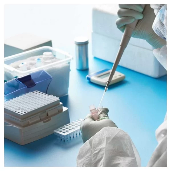 Pruebas Moleculares para M. tuberculosis
